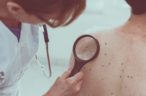 Câncer de pele: cuidados devem ser mantidos também durante o inverno
